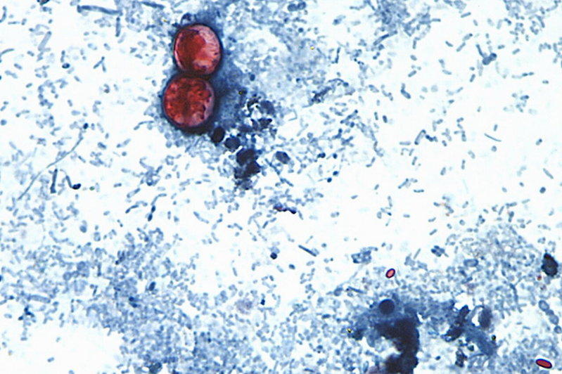 生菜环孢子虫疫情 蔓延伊利诺、堪萨斯、奥克拉荷马、宾州