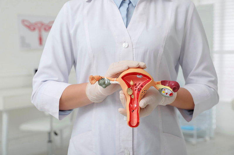 不孕找不到原因？ 医：受精卵着床路上的小障碍 「这问题」需优先考量